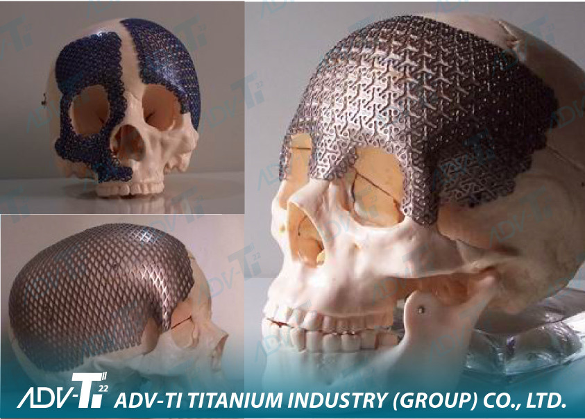 Quality ASTMB265 Medical Titanium Mesh Gr1 / Gr2 / Gr5 / Gr7 Toughness for sale