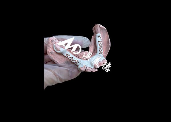 Buy Removable Denture with HPP Frame and Acrylic Base for Enhanced Durability and Comfort at wholesale prices