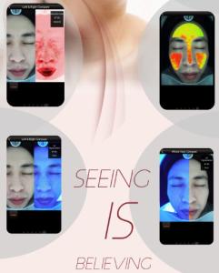 Quality Digital Skin Tester Home Analyzers With Shooting / Analyzing / Displaying 3 In 1 for sale