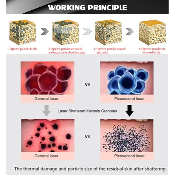 532nm 1064nm Picosecond Laser Machine Portable Tattoo Removal Laser Equipment