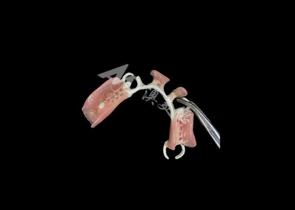 Buy Lightweight and Durable HPP Framework Partial Dentures The Perfect Blend of Strength and Comfort at wholesale prices