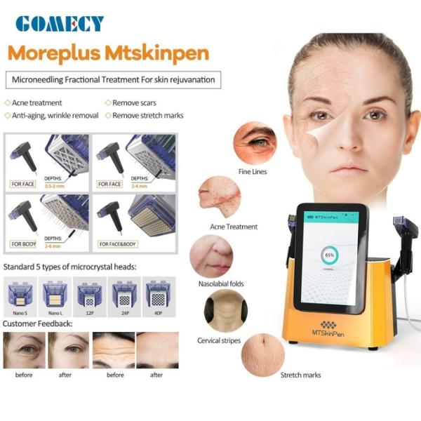 RF Microneedling Machine For Acne Sca RF Microneedle Handle Head With Cable Portable