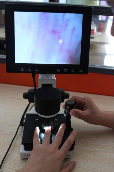 Buy High Definition LCD Microcirculation Checking Microscope Nailfold Video Detection Instrument at wholesale prices