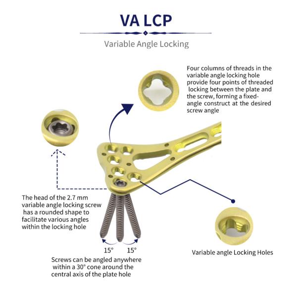Class II Multi Axial Distal Variable Angle Locking Plate