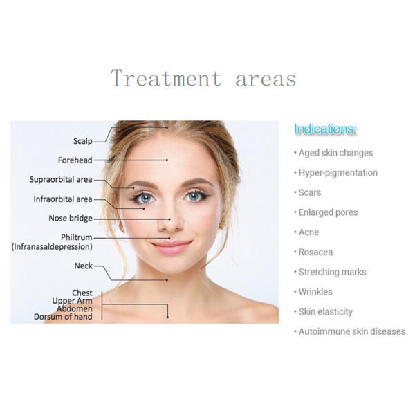 DRS 3 in 1 derma roller for face and body treatment Microneedle Roller 3 Replacement Heads Cosmetic Needling