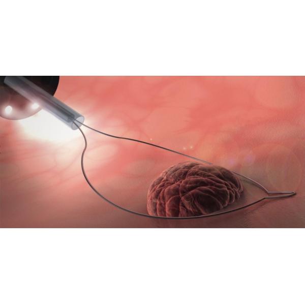 Disposable Cold Polyp Resection