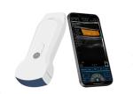 Handheld Portable Bladder Scanner Wireless Connection To Mobilephone Tablet