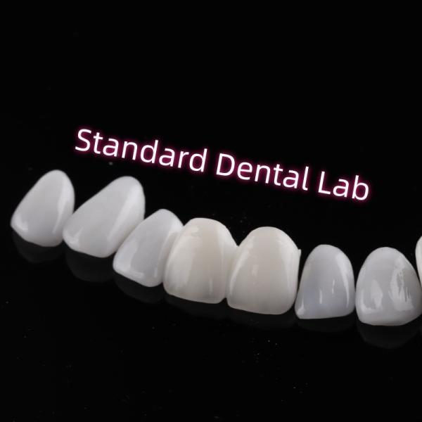 Abrasion Resistant Emax Zirconia Laminate Veneers Incisal Translucency