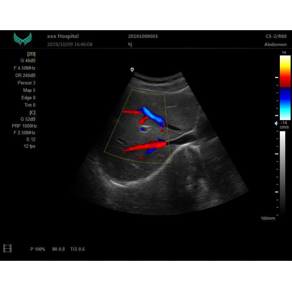 VGA USB Output Portable Digital Ultrasound Machine Handheld Ultrasound Device LCD