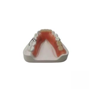 Quality Flexible Resin Denture Dental Lab Dental Acrylic Removable Partial Dentures for sale