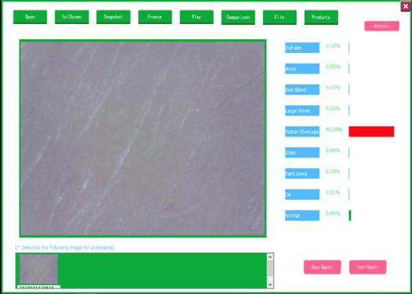 Buy Professional Video Dermatoscope Analysis System With Analysis And Testing Report at wholesale prices