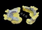 Custom Cast Partial Denture Natural Looking Solution For Enhanced Comfort And