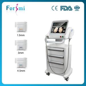 China Hifu high intensity focused ultrasound best rf skin tightening face lifting machines on sale