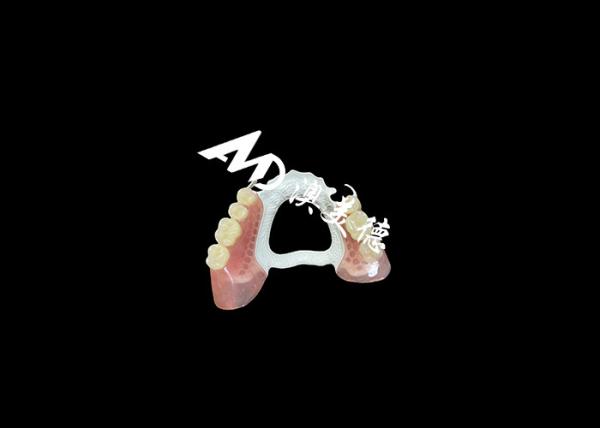 High-Quality Removable Denture with Durable HPP Framework and Comfortable