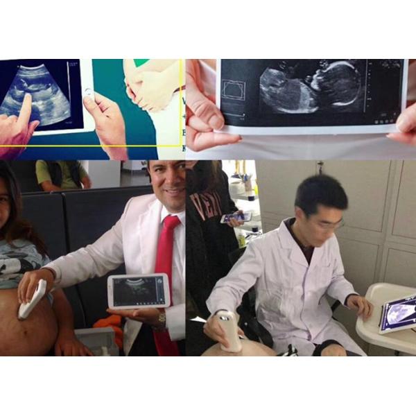 Pocket Handheld Ultrasound Scanner With Wifi Connected To IPad Mobilephone Doppler Ultrasound Portable 128 Elements