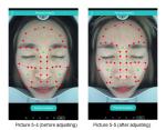 Powerful 3D Digital Skin Analysis Machine Cloud Sharing Android Software