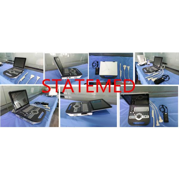 B Display Mode Color Doppler Ultrasound Scanner Convex Array 8 Segments TGC