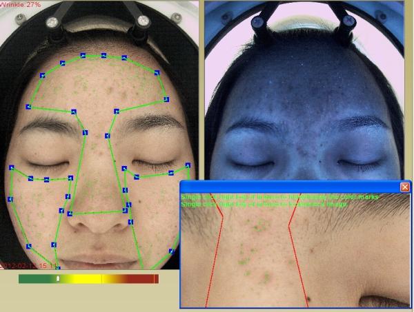 Buy Cosmetics Using 3D Wrinkle Analysis Machine RGB + UV + PL 3 Spectrums at wholesale prices