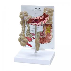 Quality Advanced Medical Human Large Intestine Anatomy Model For School Hospital for sale