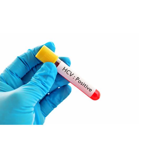 Qualitative Hepatitis Rapid Test Kit