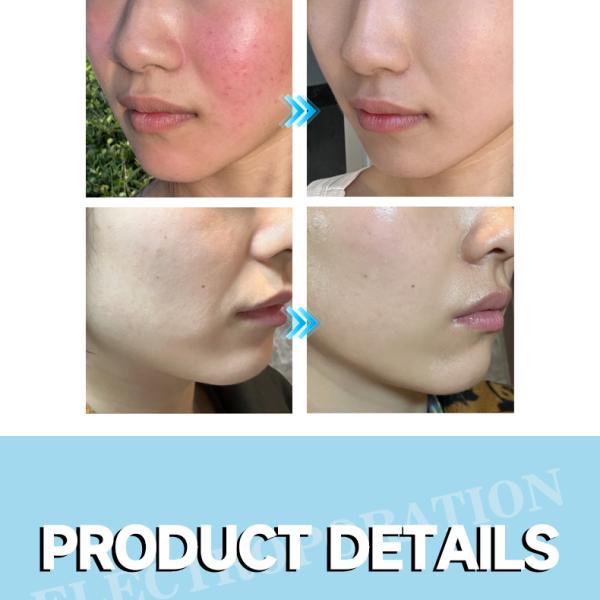 Get Glowing Skin With Cold And Heat Electroporation Skincare System D501 The Perfect Solution For All Your Skin Care Needs