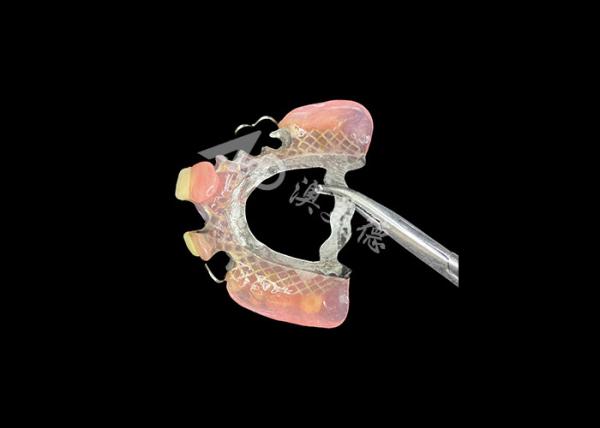 Buy Customizable Fit Cast Partial Dentures for Precision Durability and Comfort in Partial Tooth Replacement at wholesale prices