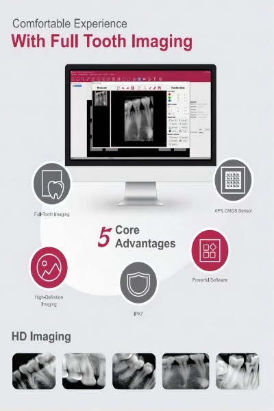 Lightweight Dental X Ray Device Sensor Camera Digital X Ray Equipment