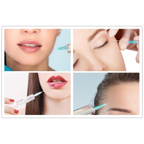 Fosyderm 1ml Cross Linked Dermal Filler Hyaluronic Acid For Nose Injection Safety