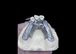 Quality Easy Fit Custom Cast Partial Denture Stable and Natural-looking Framework for Fast Results for sale