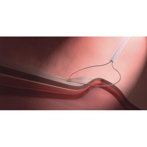 Disposable Cold Polyp Resection