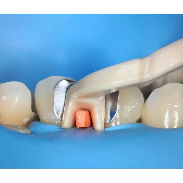 Dental Sectional Matrix System F1 Autoclavable includes Matrix Bands M2 + Clamp Ring R3 1.0