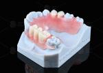 Natural Looking Valplast Partial Denture Longevity Highly Resistant To Fractures