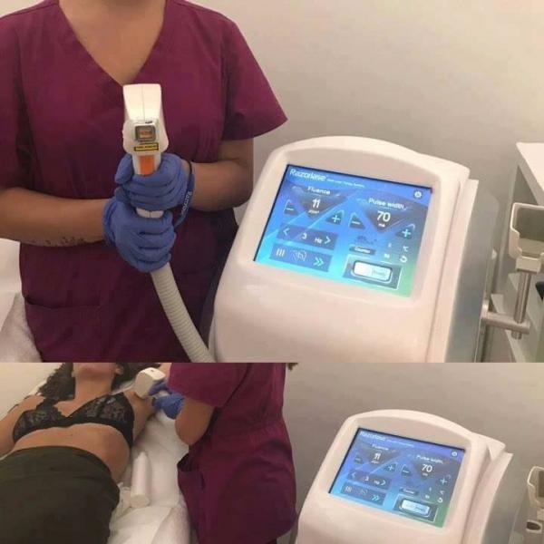 Buy Diode Permanent Hair Removal Laser Machine For Clinic SDL-B 120J/cm2 at wholesale prices