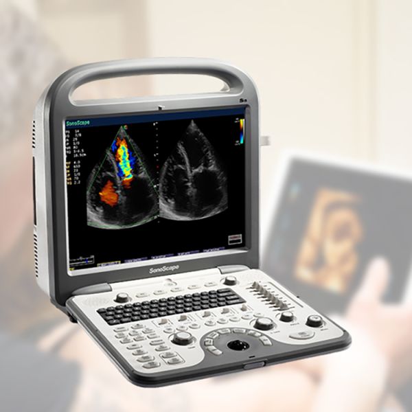 Sonoscape S8 B/ 2B/ 4B/ M/CW Echocardiography Ecograph 4D Laptop Notebook Portable Color Doppler