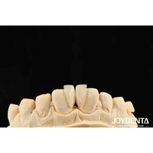 Quality High Durability Micro Veneer 0.2mm Thickness And Dependable Performance for sale