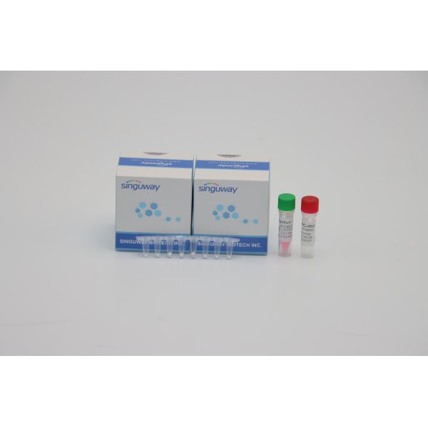 Lab POCT IVD Mycobacterium Tuberculosis TB PCR Detection Kit DNA Testing ISO9001