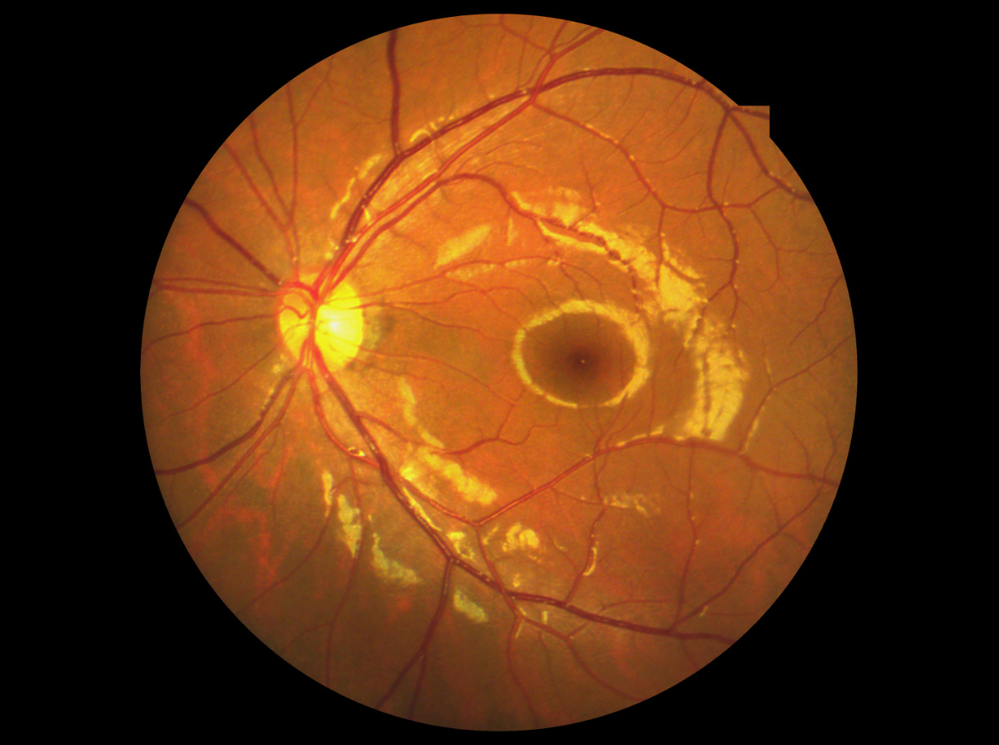 Manual Non Mydriatic Fundus Camera , Mini Digital Eye Fundus Camera