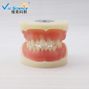Quality VIC-E15 Teeth Study Model Artificial Physician Certified Tooth Extraction Model for sale