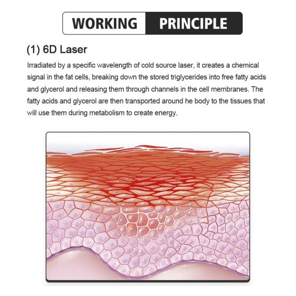 Non Surgical Body Fat Freezing Machine Air Cooling Body Contouring Equipment